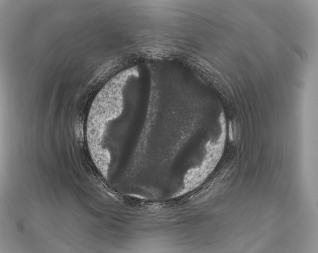 X0000111001155200907171807