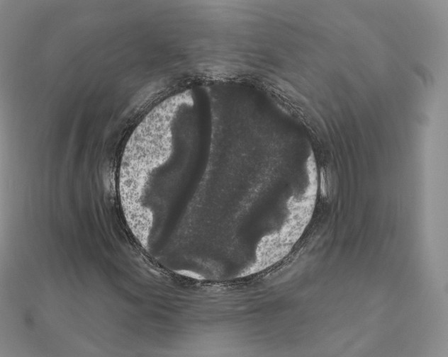 X0000111001155200907311025