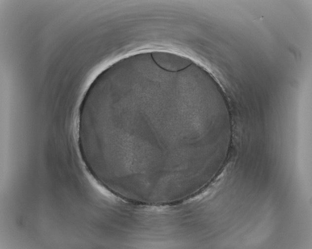 X0000111011519200906261509