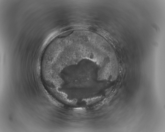 X0000111010053200907061003