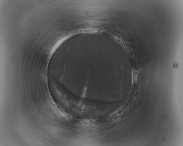 X0000111020147200906191700