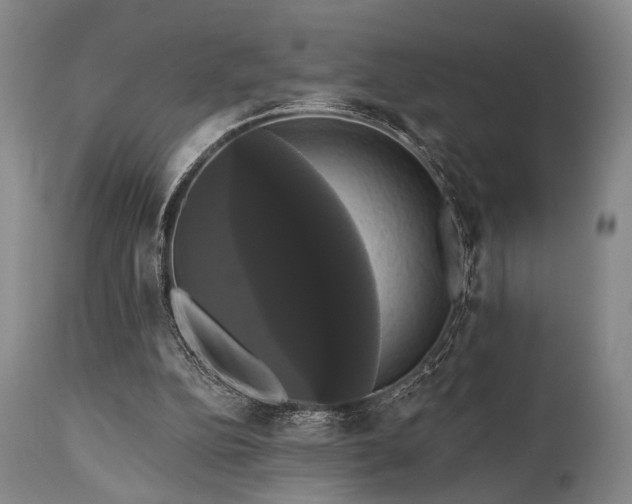 X0000111020152200906191700