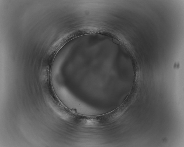 X0000111020165200906191700