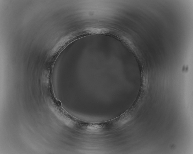 X0000111020357200906191658