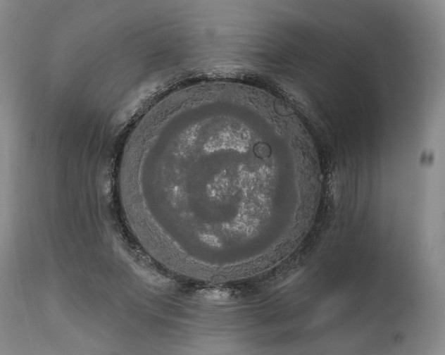 X0000111020687200906191652
