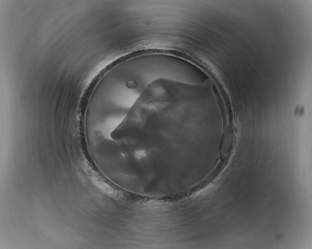 X0000111020779200906191651