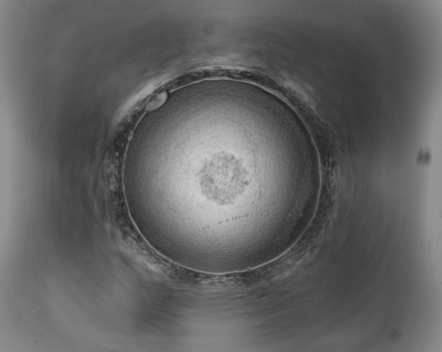X0000111021159200906191645