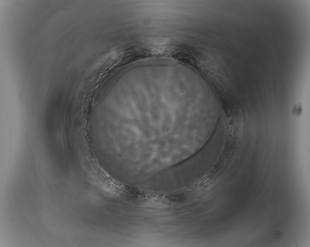 X0000111021249200906191644