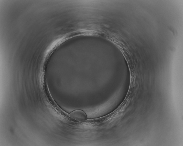 X0000111020149200906261548
