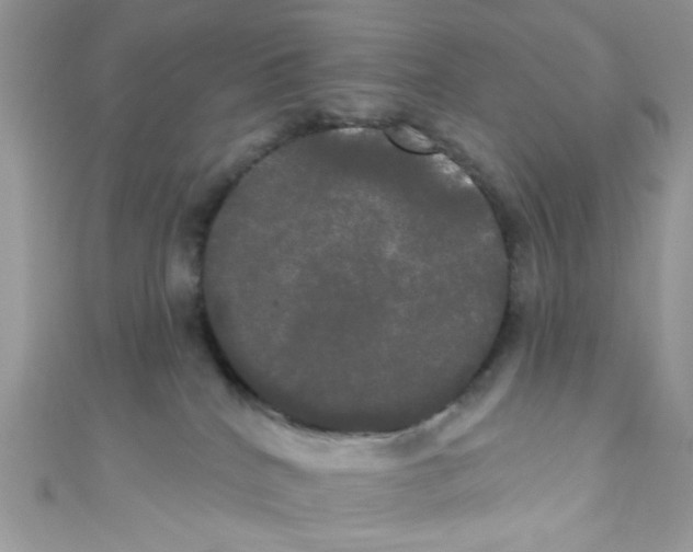 X0000111020040200907171904