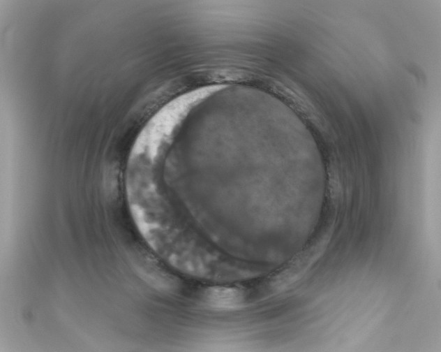 X0000111020169200907171902