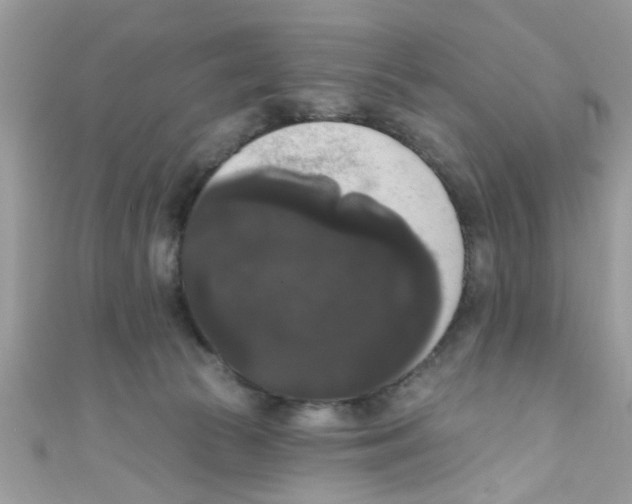 X0000111020177200907171903