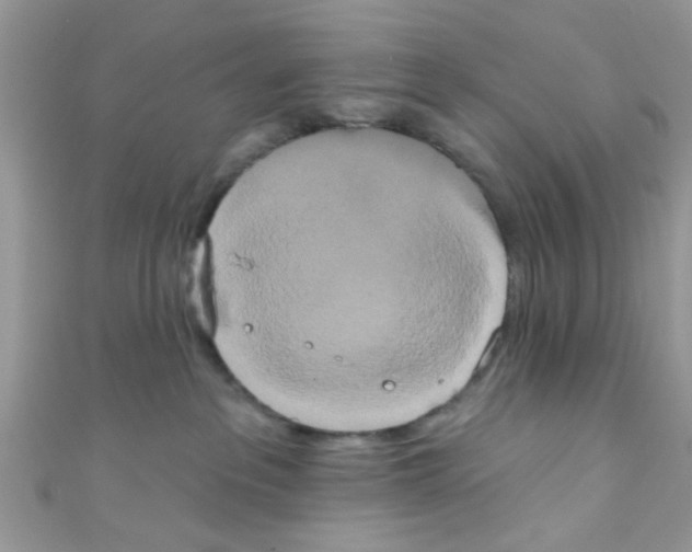 X0000111020237200907171901