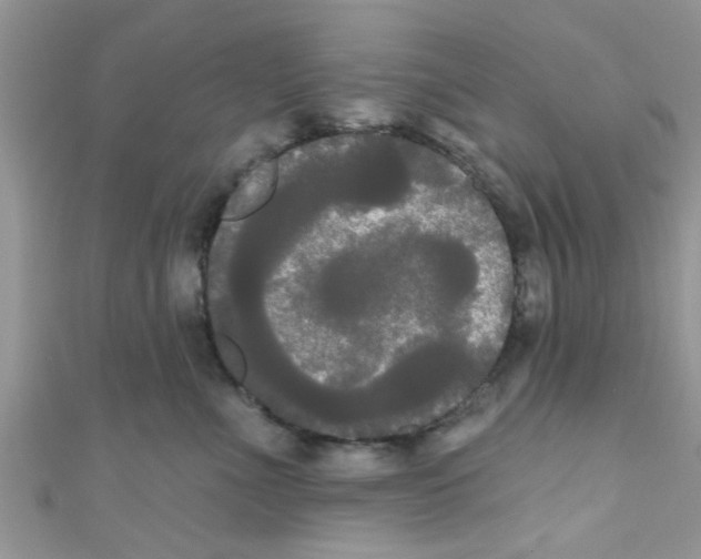X0000111020523200907171858