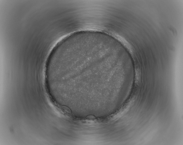 X0000111020580200907171857