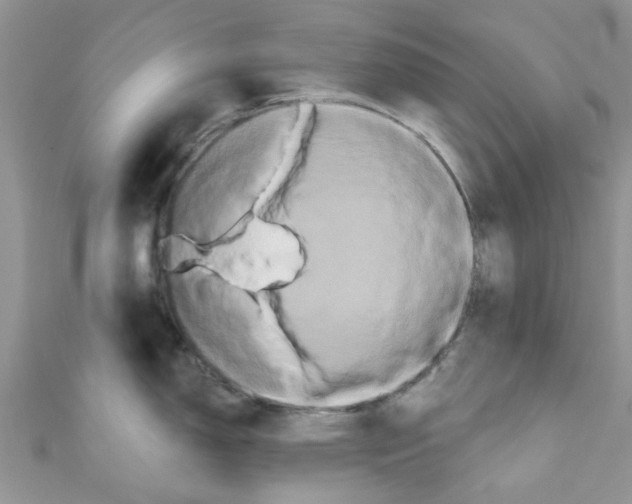 X0000111021150200907171850