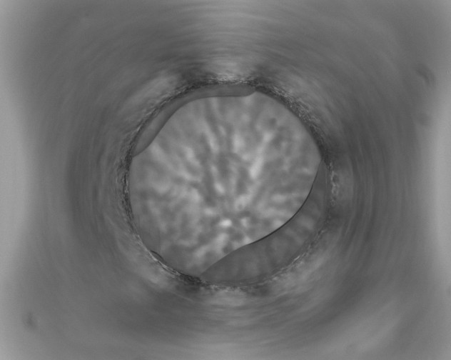 X0000111021249200907171848