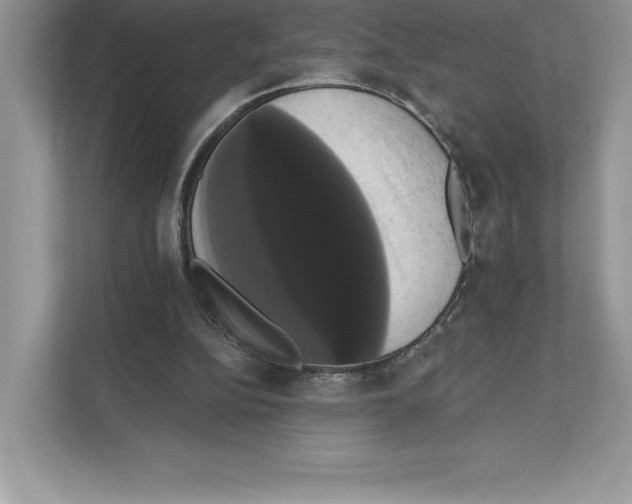 X0000111020152200907310939