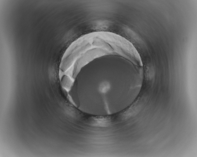 X0000111020370200907310936