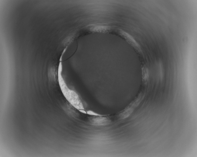 X0000111020669200907310933