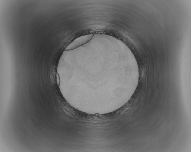 X0000111020868200907310930