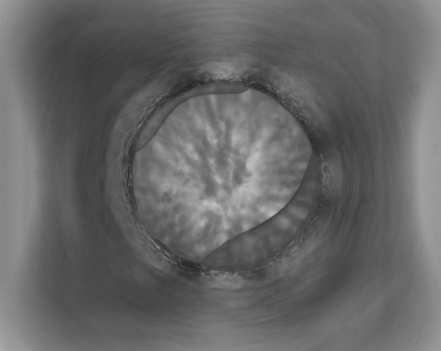 X0000111021249200907310925
