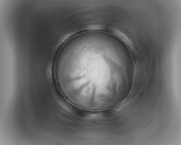 X0000111030155200907021545