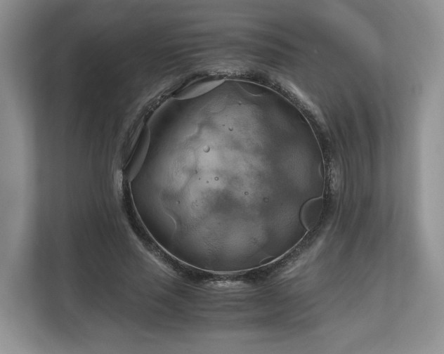 X0000111030637200907021539
