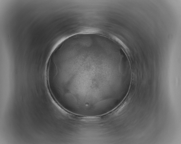 X0000111031487200907021528