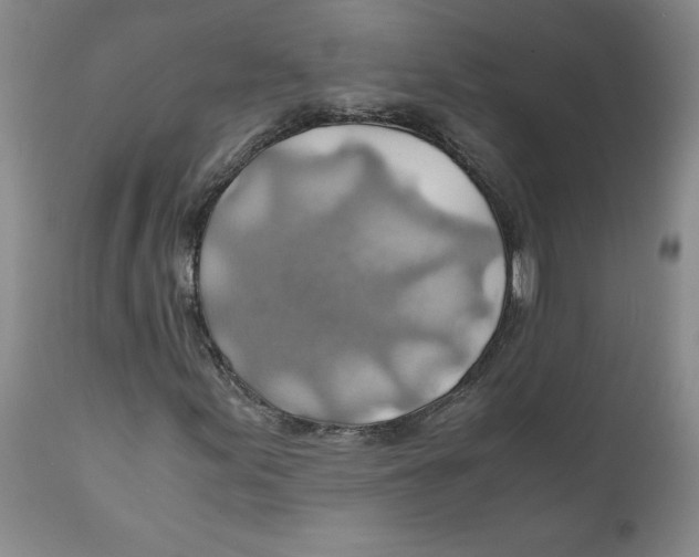 X0000111031155200907231614