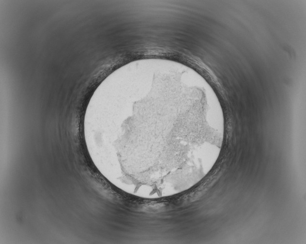 X0000111030257200908061442