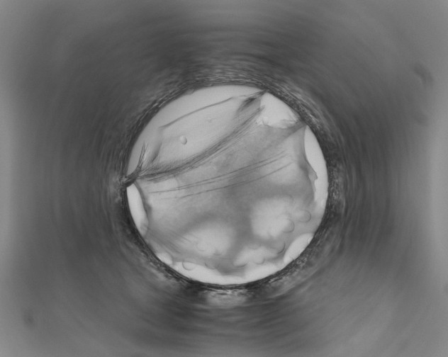 X0000111030465200908061440