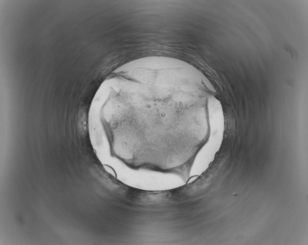 X0000111030479200908061440