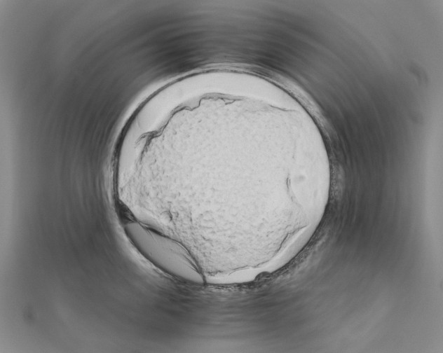 X0000111030955200908061433