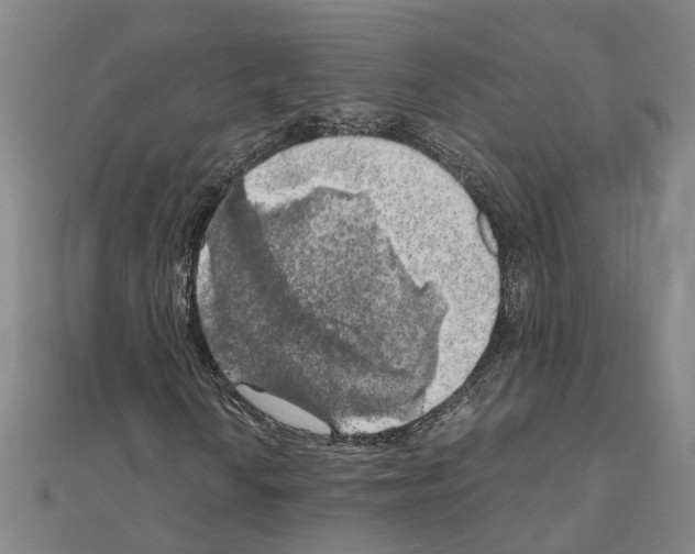 X0000111031010200908061431