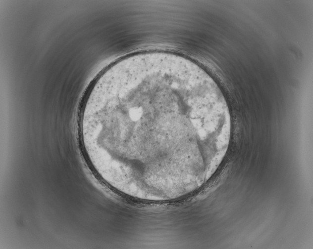 X0000111031038200908061431