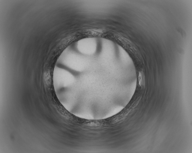 X0000111031395200908061425