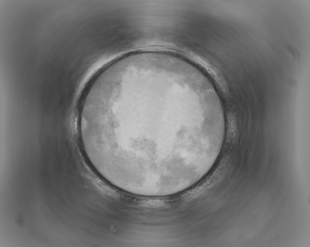 X0000111031462200908061425