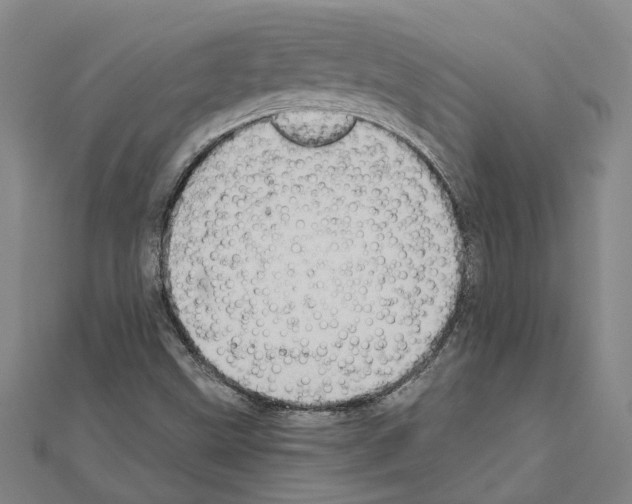 X0000111031499200908061424