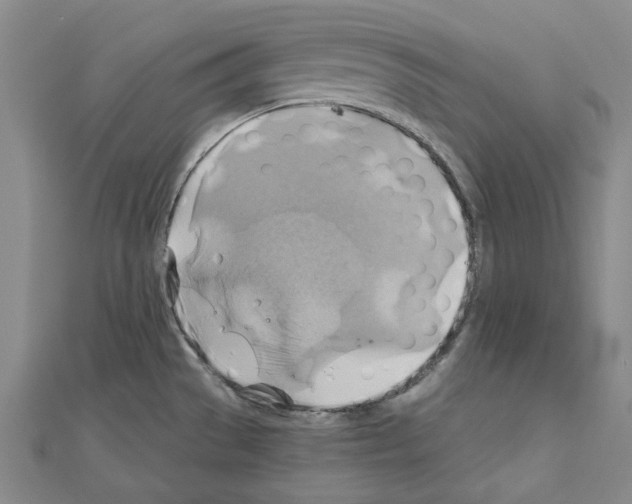 X0000111031529200908061425