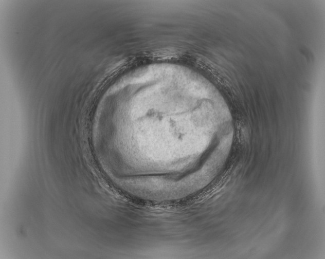 X0000111041393200907161335