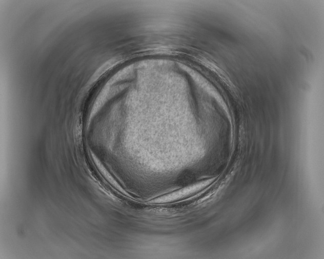 X0000111041450200907161335