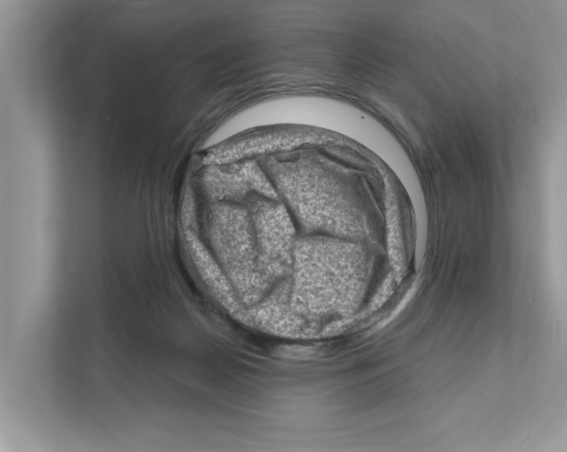 X0000111040170200907231543