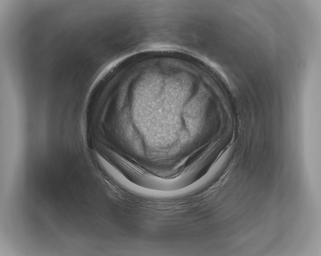 X0000111041319200907231527