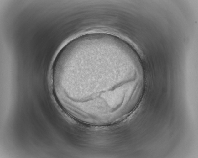 X0000111041522200907231525