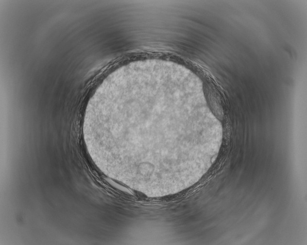 X0000111041110200908061451