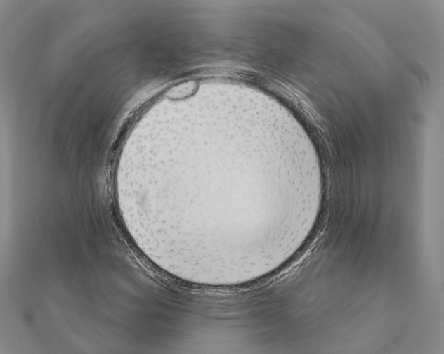 X0000111041164200908061451