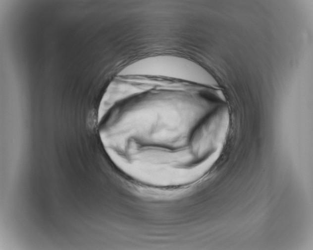 X0000111050048200907231605