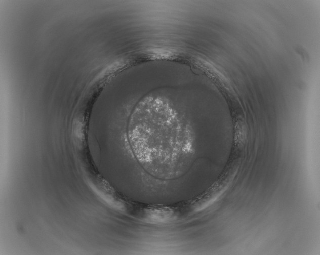 X0000111050215200908061524