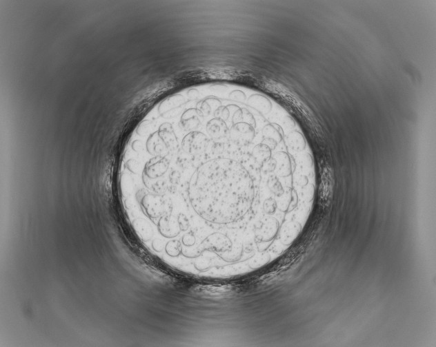 X0000111050639200908061518